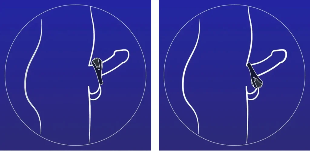 Hot Octopuss ATOM Powerful Vibrating Cock Ring - How it Works