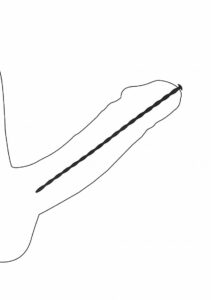Shots Ouch! Silicone Spiral Screw Beginner Urethral Sound Set - depiction of penis insertion