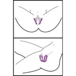 Frisky Oral Sex Enhancing Labia Spreader